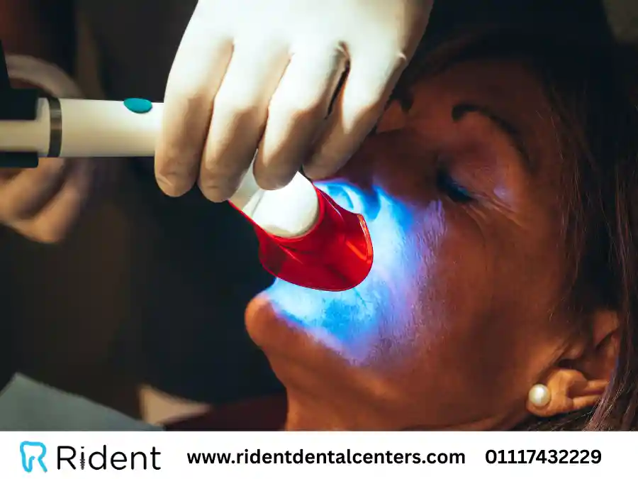 طريقة تبيض الاسنان في العيادة| 3 خيارات الأخيرة أفضلهم